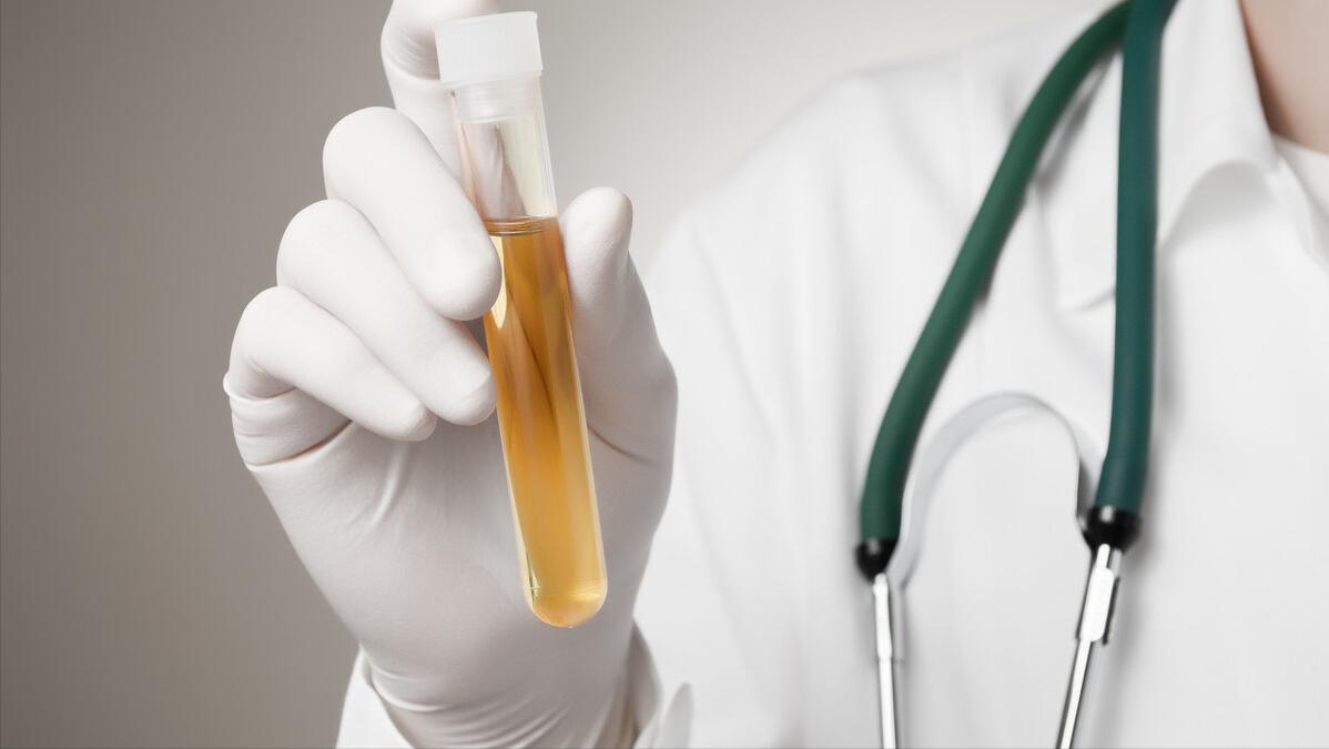 糖尿病高血压和肾病,糖尿病肾病与高血压肾病的治疗