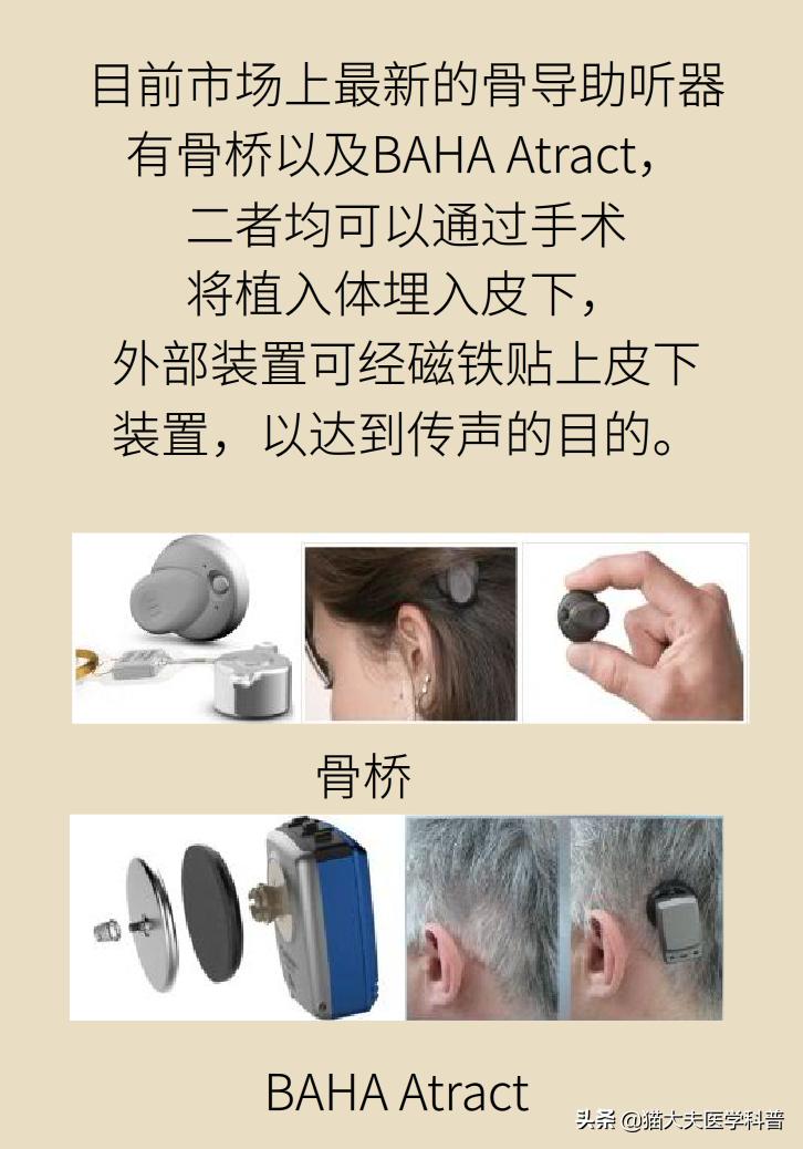 老年耳朵聋能治疗吗,老年耳聋治疗前景