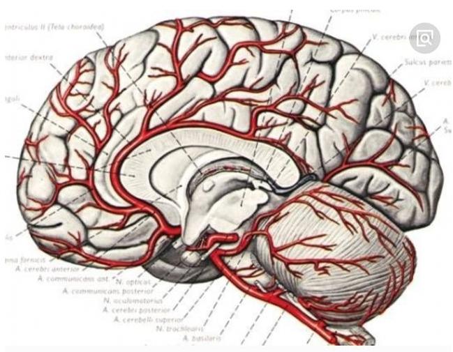 中风为什么,为什么中风后会失语