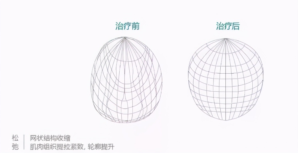 热拉提抗衰,抗衰老的杀手锏热拉提plus