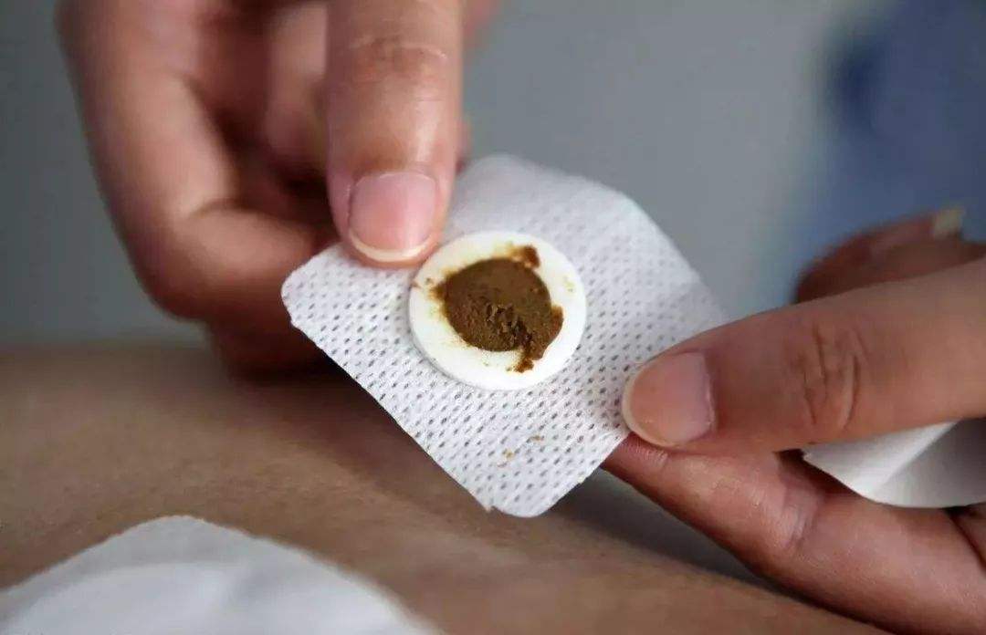 口腔溃疡贴涌泉的偏方,涌泉穴贴生姜能治口腔溃疡吗