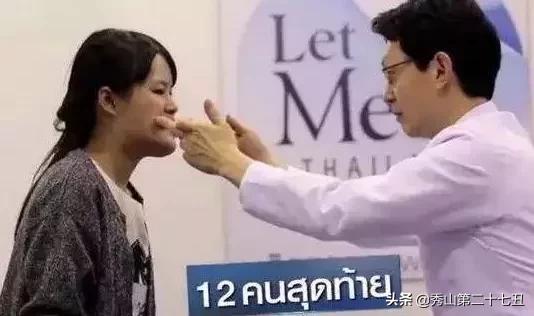 龅牙妹因为丑生活处处受挫，下定决心整容后，人生发生大翻转