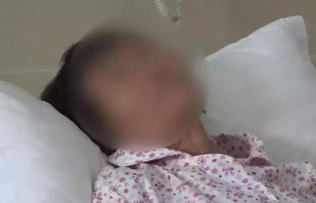 70岁老人胃胀经常腹泻控制不住,75岁老人取出巨脾