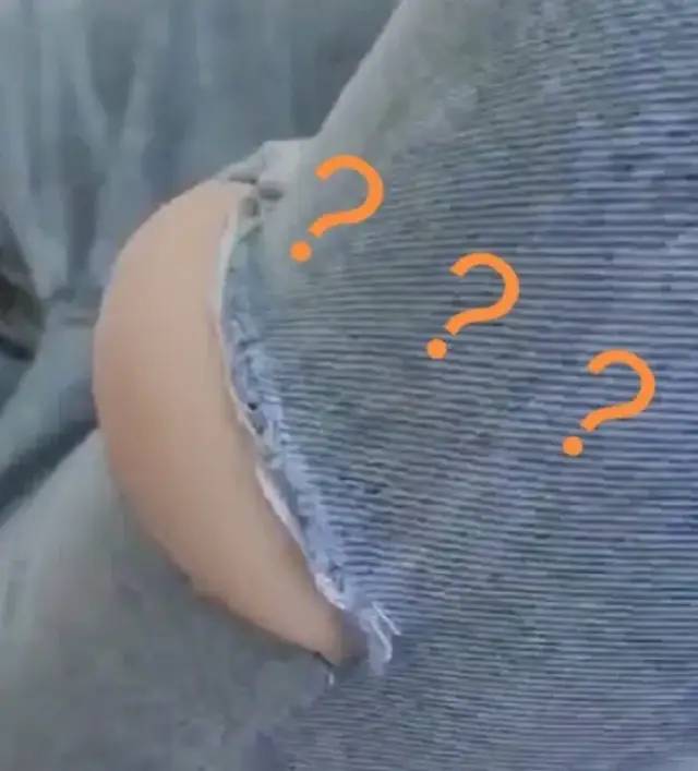 溜冰摔倒了膝盖不能弯曲,溜冰摔倒膝盖肿了怎么办