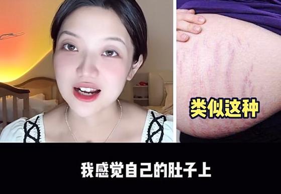 童星因鼻子变大遭网暴,本尊辟谣是怀孕的原因,肚子还全是妊娠纹