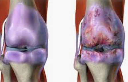 你的膝盖还好吗？细数你想不到的伤膝习惯，看懂了受益匪浅