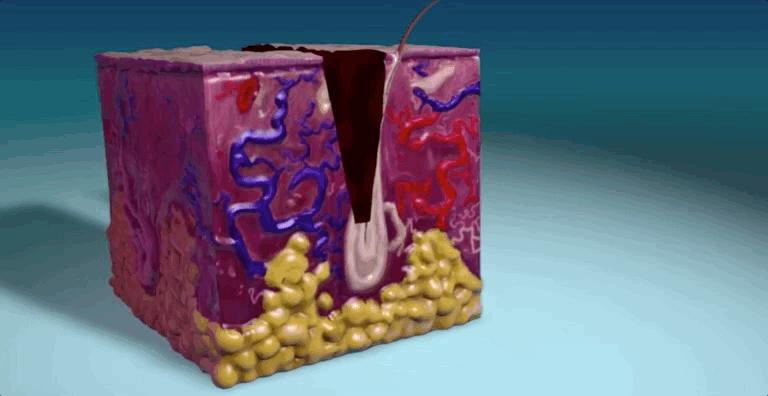 揭秘伤口如何愈合的,伤口是如何愈合的告诉小朋友