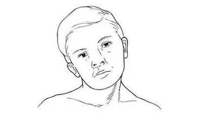 痉挛性斜颈如何治疗为好,痉挛性斜颈如何治疗你了解吗