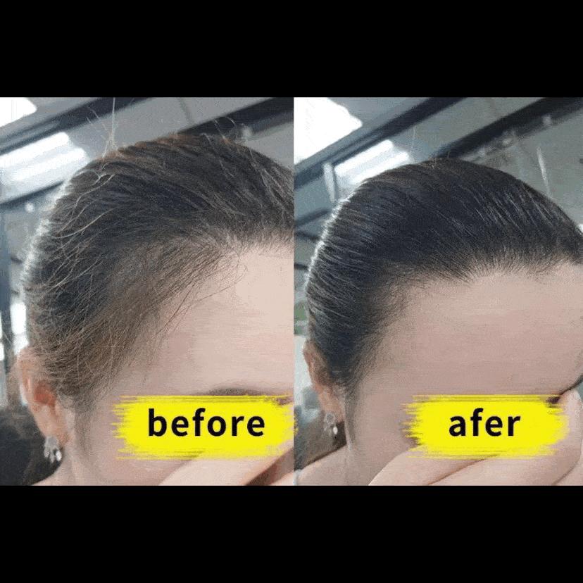 碎发多炸毛没有碎发神器,碎发整理神器戴法