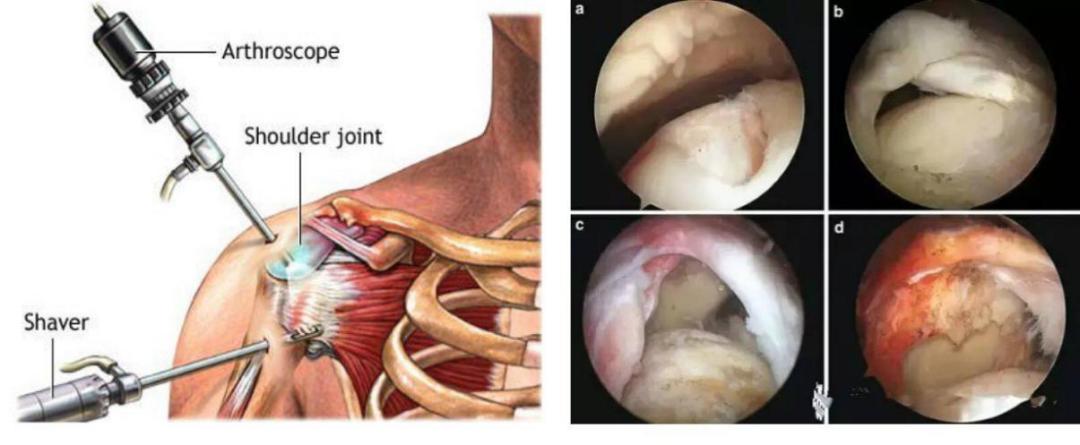赶走疼痛,一身轻松!腰背痛,太原市中心医院疼痛科有妙招