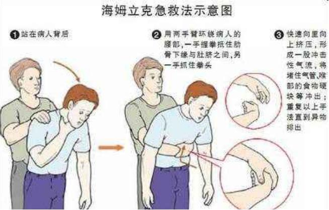 宝宝误食异物海姆立克急救法,宝宝被噎住妈妈海姆立克急救法