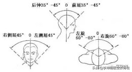 李坤明医生提醒你：颈椎相关疾病的治疗和预防,三）颈椎病（2）
