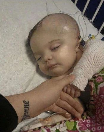 几月内婴儿容易患上摇晃综合征,婴儿摇晃综合征的十大禁忌