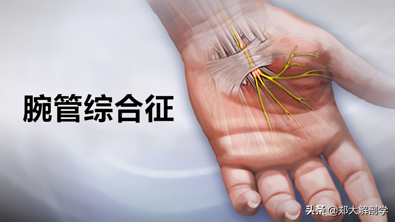 臂丛三束的主要分支,臂丛锁骨下部的主要分支及分布