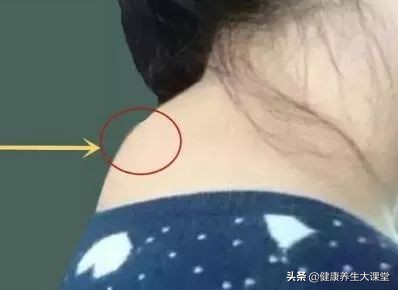 铲平富贵包,平整富贵包