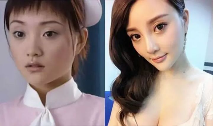 整成网红脸,为什么明星喜欢整成网红脸