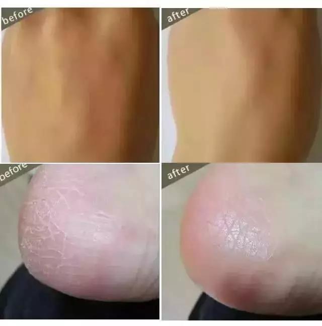 保湿的身体乳公认最好用,抹了身体乳皮肤干燥起皮