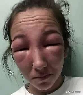 在加拿大最危险的五件事情,加拿大有什么危险动物或昆虫