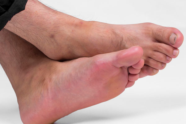 老是脚痒,糖尿病脚痒怎么缓解