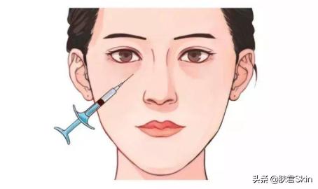 有什么沟必须火的,泪沟后面有一条很深的沟叫什么