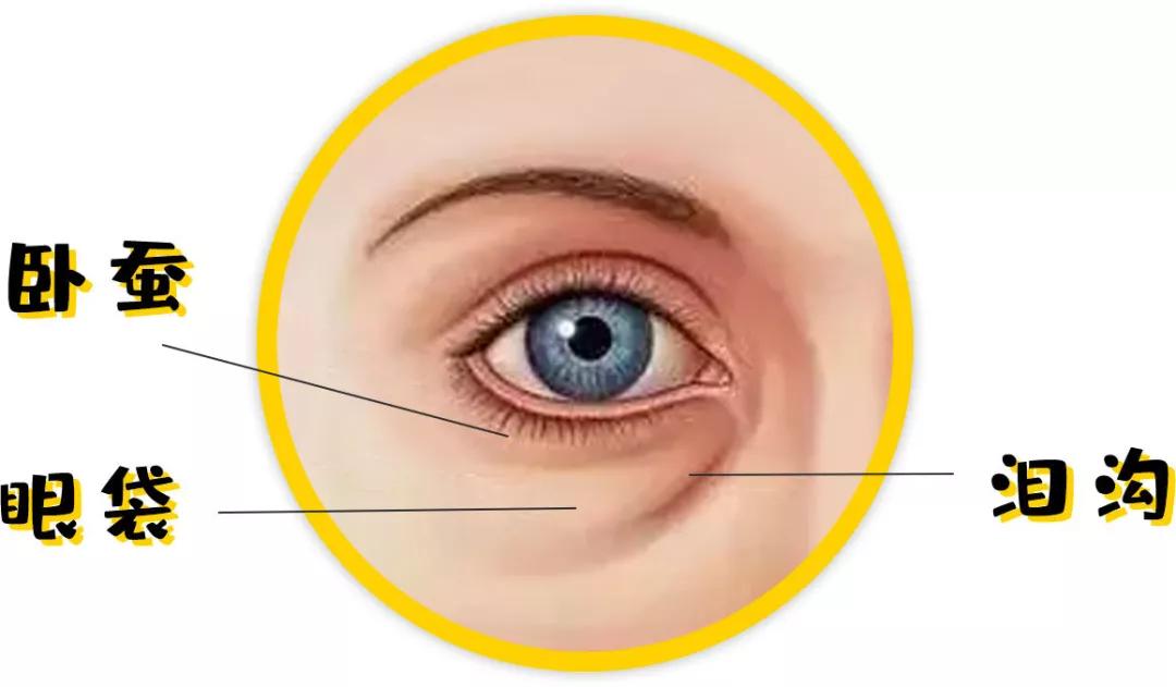 眼袋和卧蚕有什么区别怎么祛眼袋,一招教你怎么判断眼袋还是卧蚕