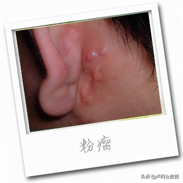 整形会有后遗症吗？为什么整形会上瘾