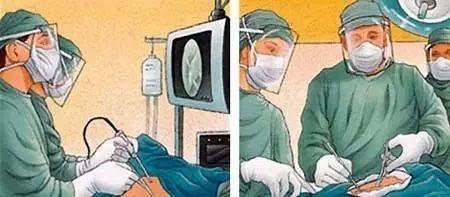 肩关节反复脱位影响干体力活吗,肩关节反复脱位核磁表现