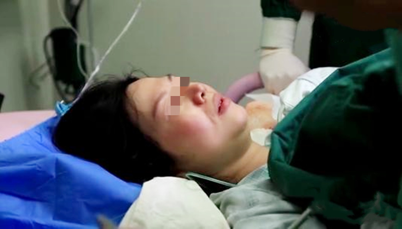 顺产后身上出现红点,顺产以后脸上有斑点