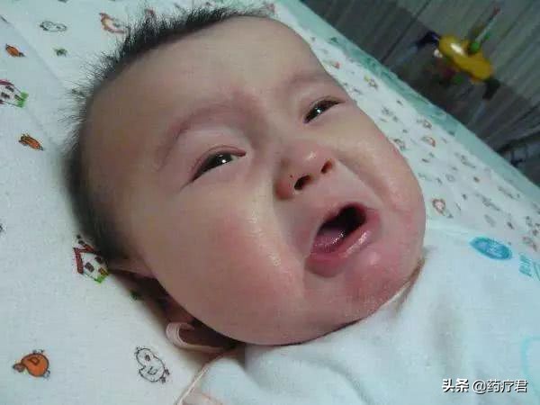 宝宝湿疹会引起皮肤发红吗,宝宝皮肤干起湿疹怎么办