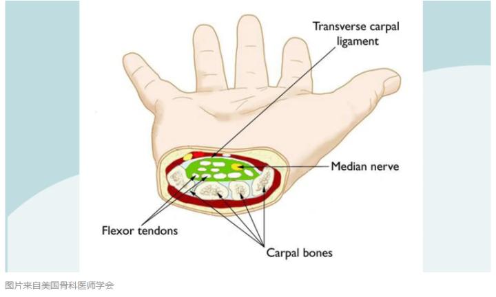 手臂和手逐渐疼痛难耐？这可能是高血糖导致的