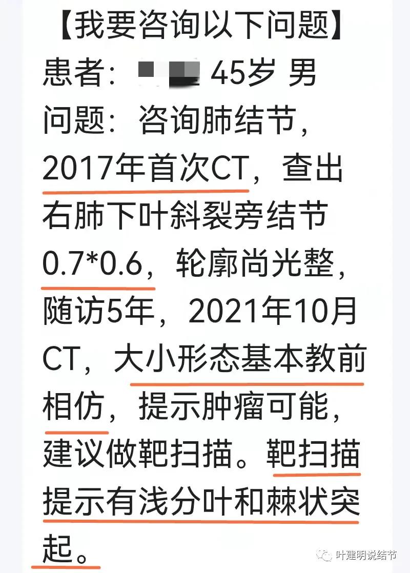 问诊分析:存在了4年的实性结节会不会是肺癌?