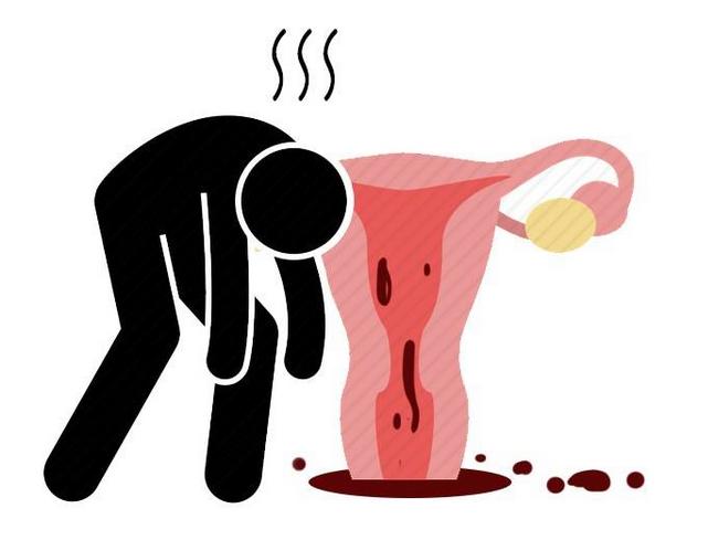 女性湿气重妇科什么症状,女性妇科滴虫病的症状