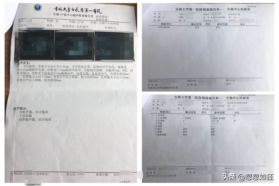 高龄备孕（四）：输卵管超声造影前问个傻问题，大夫一听笑了……