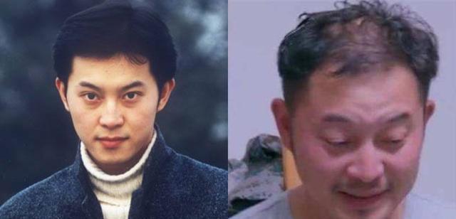 很秃却很帅的男明星,秃头但是很帅的男网红