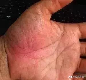 手上这块肉能看出你的身体好坏,手掌根部有肉的人是不是头脑笨