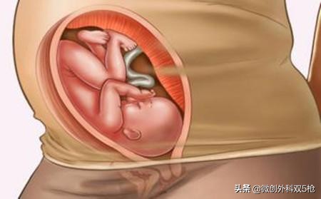 男人永远体会不到！女人是冒着生命危险来怀孕的