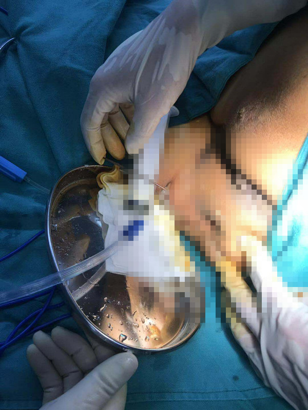 唐山中医院康复科怎么样,唐山市截瘫医院