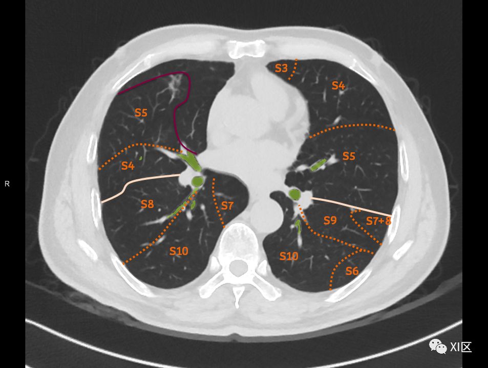 如此详细的肺部影像解剖，有点儿酷！
