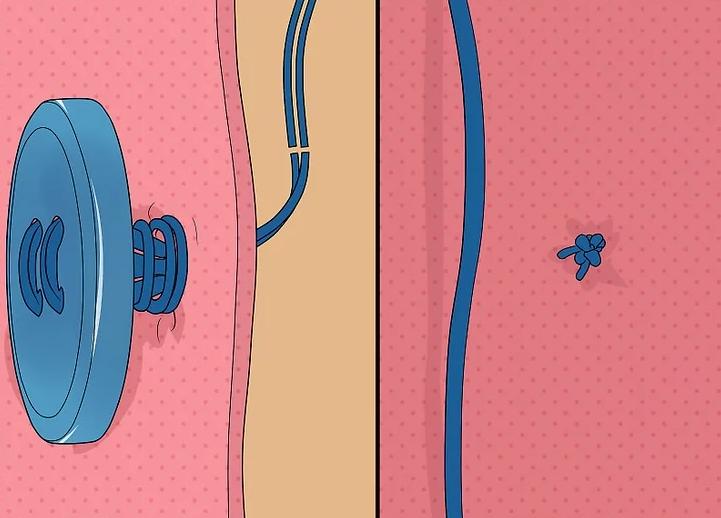 怎样缝制大衣暗口袋,如何缝制外套