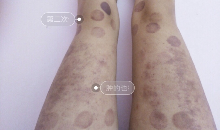 瘦萝卜腿的方法简单,夏季拯救大粗腿的食物