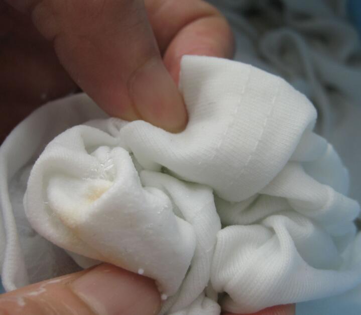 白t恤上的发霉印怎么去除,白t恤发霉了怎么办