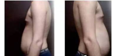体重不大但是肚子有赘肉,体重不大肥肉多