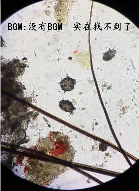 家里除螨虫最好的神器,螨虫清除神器是否能清除螨虫