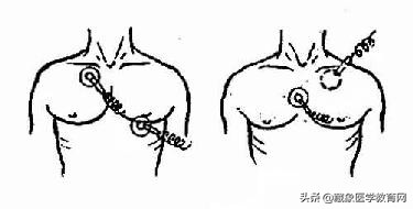 最全急救常识关键时刻能救命,掌握急救知识及时挽救生命