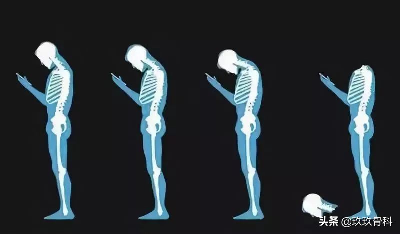 颈椎死穴,颈椎上的死穴在哪里