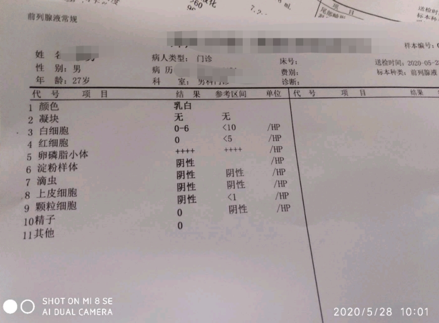 复发性流产男性该查什么,复发性流产男士需要查什么