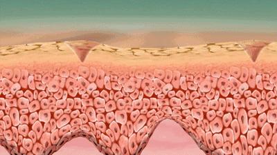 一张嘴就臭是咋回事,刷牙不管用的口臭怎么治