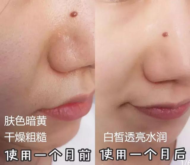 一白遮百丑光速见效的美白精华,平价美白精华真实有效