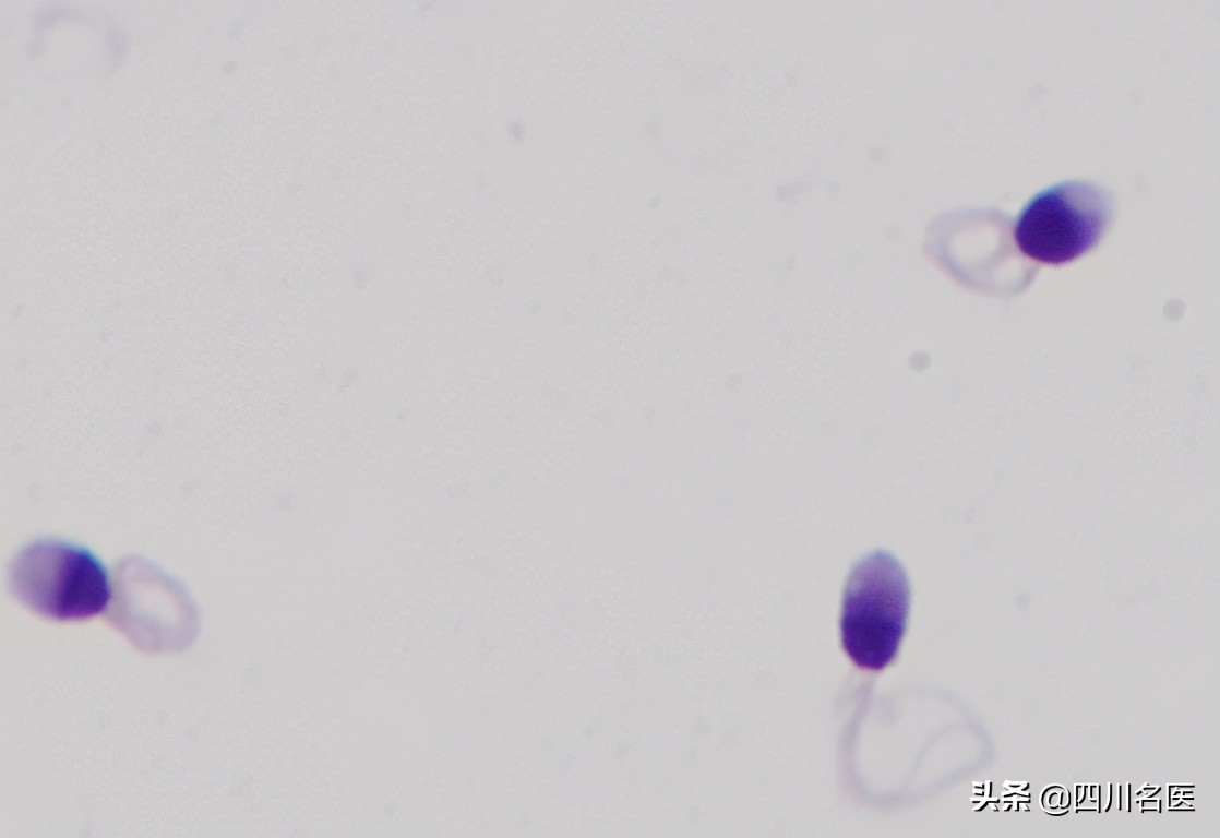 精子是如何产生的百科,精子是不是每天都能生成