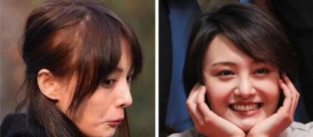 女生头发太贴头皮怎么处理,女生头发太少太软太贴头皮怎么办